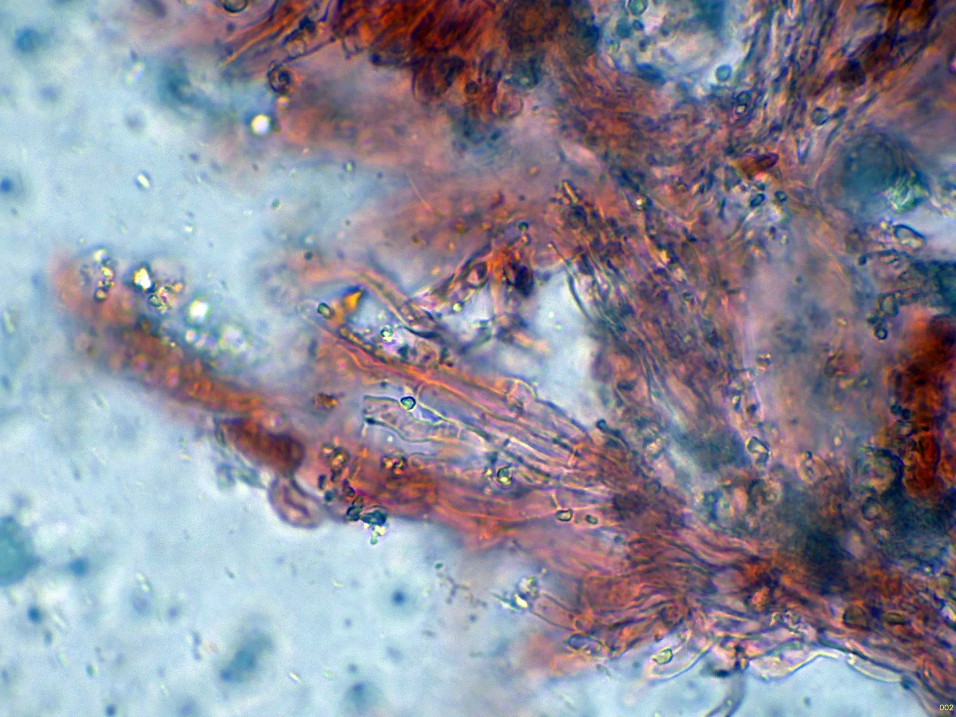 10 - Hifas subhimeniales-002